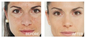Bright Skin Masque Before and After Image